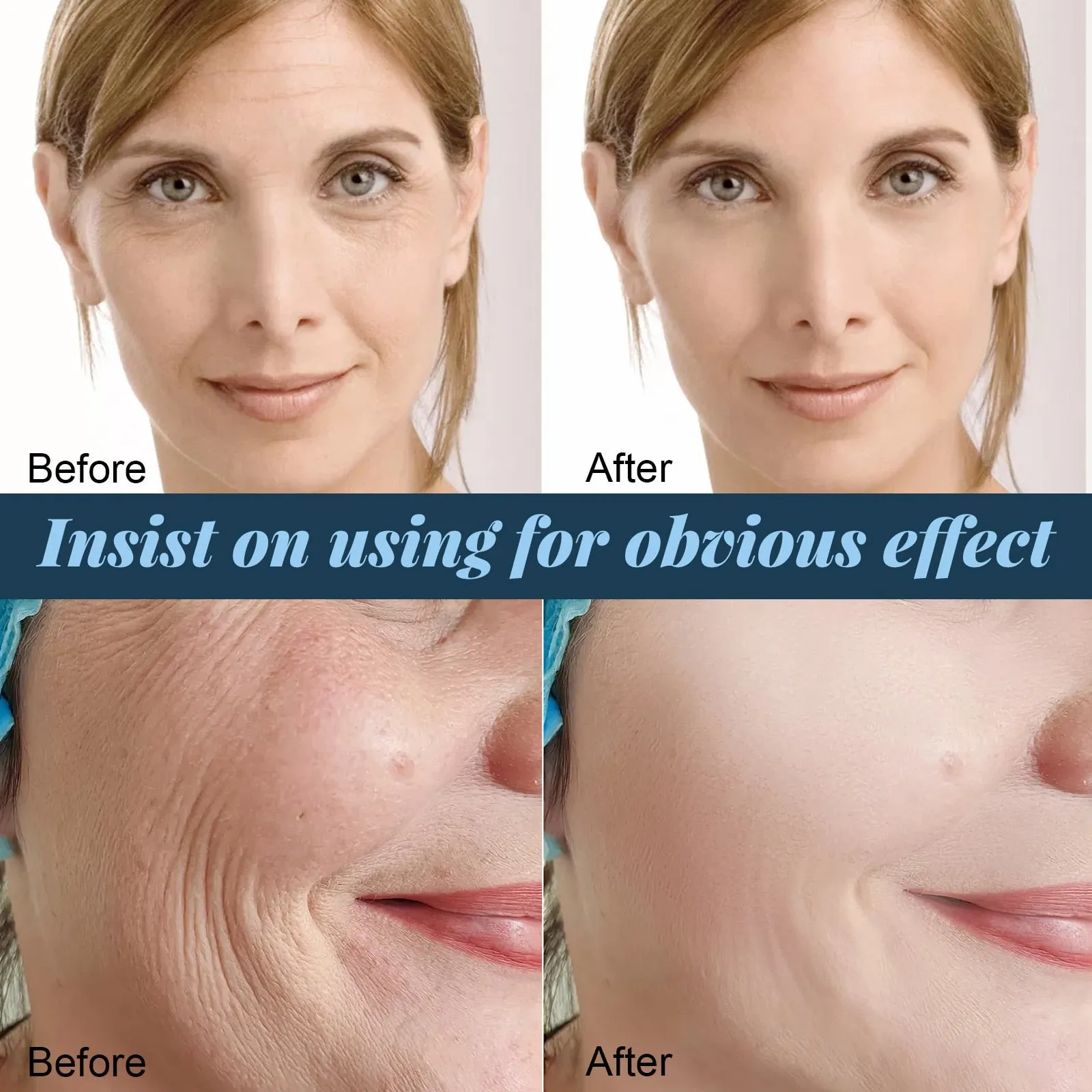 60pcs Gold Protein Line Anti-wrinkle Firming Facial Filler No Needle Absorbable Fade Fine Lines Collagen Thread Anti-Aging Serum