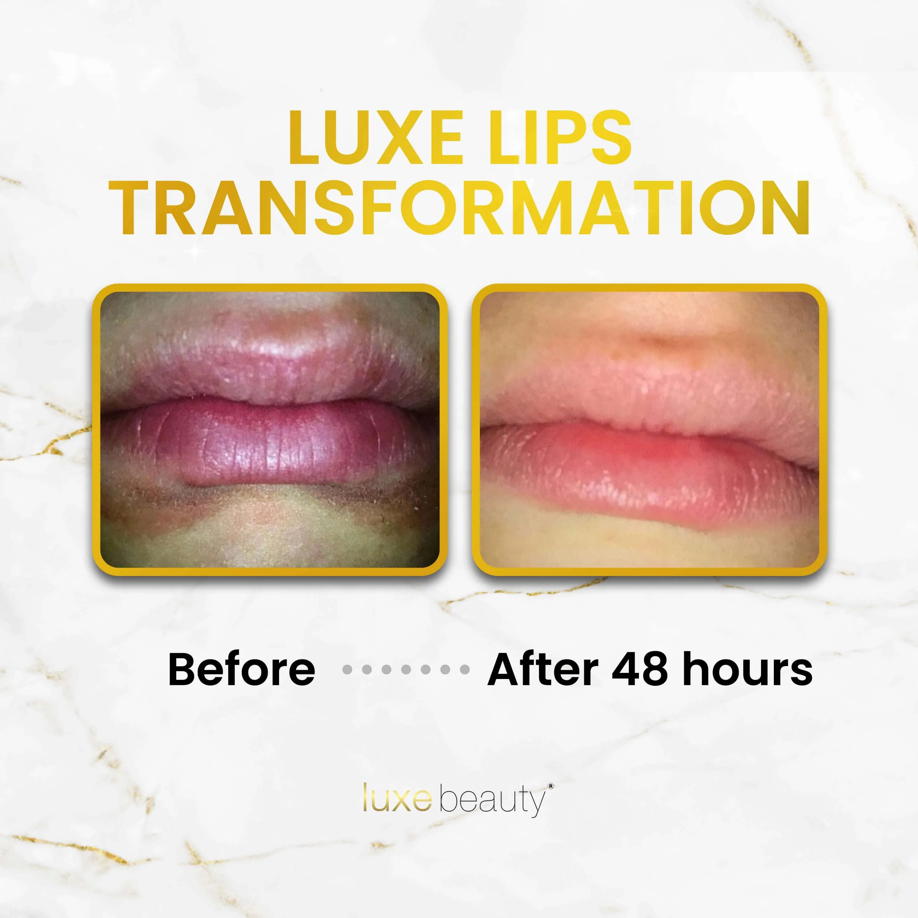 Beeswax Free, Nut Free Lip Balm - Luxe Lips - Vanilla Cupcake