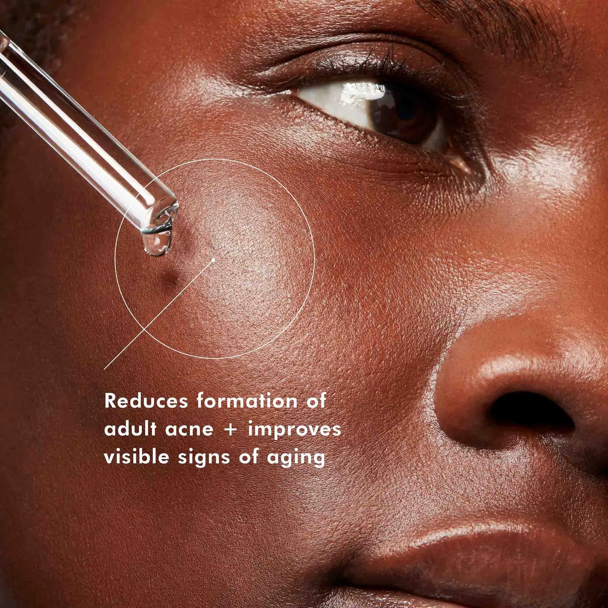 Blemish   Age Defense