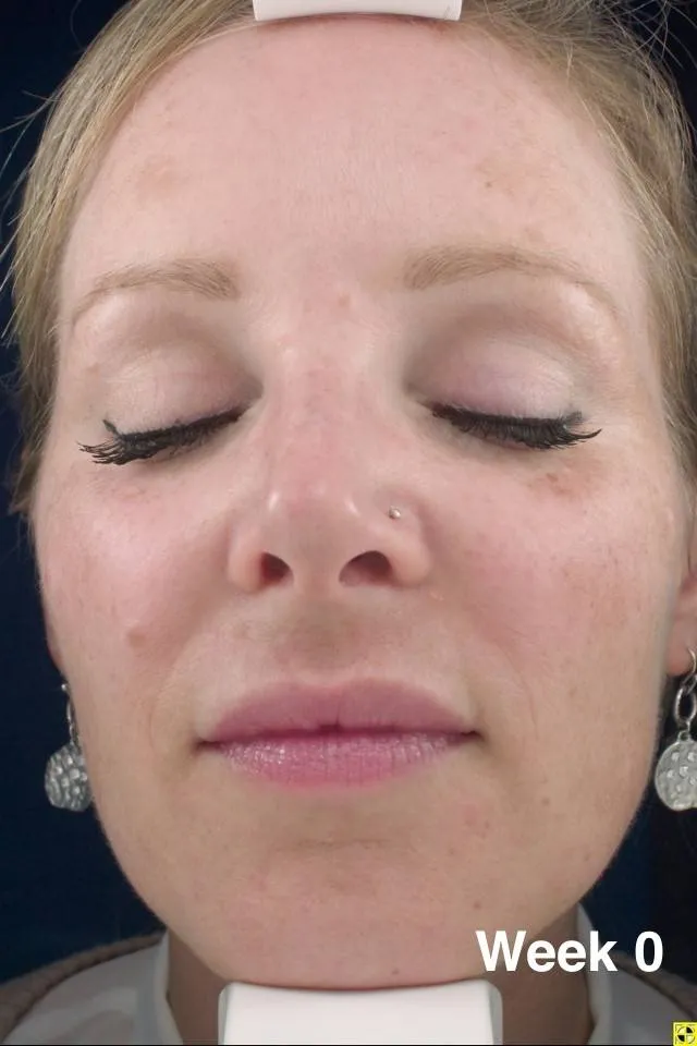 Radiance Serum 30ml